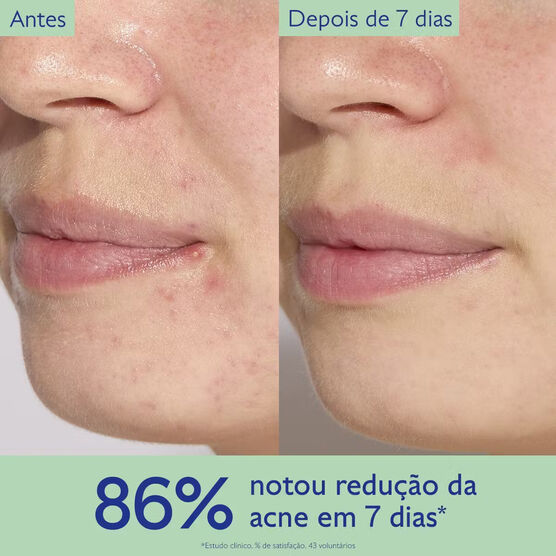 Sérum Facial Salicílico Caudalie Vinopure